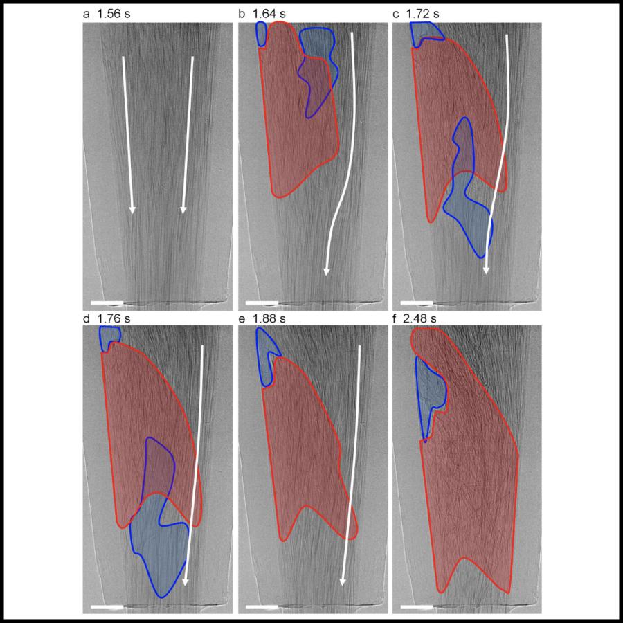 clog development sequence