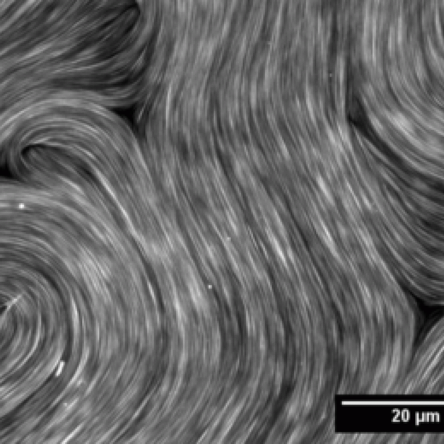 Active matter extracts energy from its surroundings at the single particle level and transforms it into mechanical work. Here active nematics – a type of active system that is characterized by self-driven units with elongated shape – creates turbulence and topological defects.