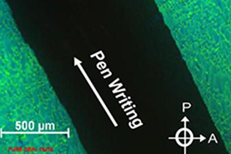 polarized light microscopy image