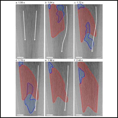 clog development sequence