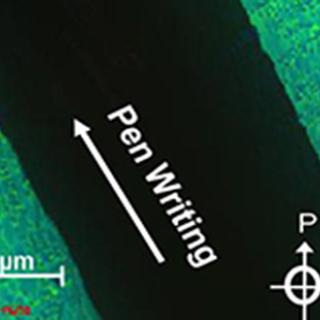 polarized light microscopy image